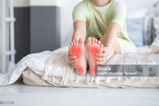 Fascite plantar, muito comum no verão