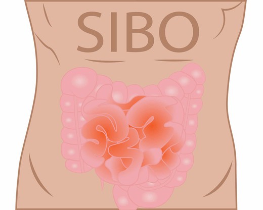 SIBO