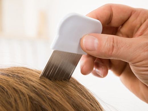 Antipiojos y prevención de piojos