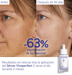 Caudalie Vinoperfect Sérum Resplandor Antimanchas