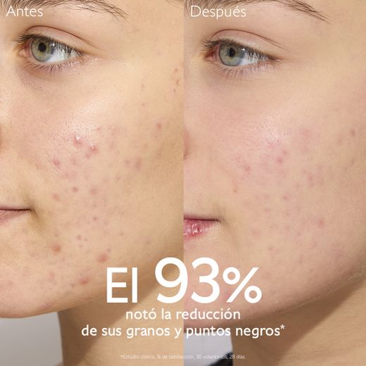 Caudalie Rotina Anti-Imperfeições Pack 4 Produtos