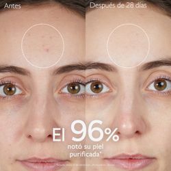 Caudalie Vinopure Gel de Limpeza Purificante 150ml