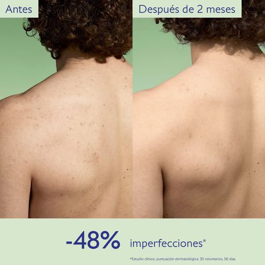 Caudalie Rotina Anti-Imperfeições Pack 4 Produtos