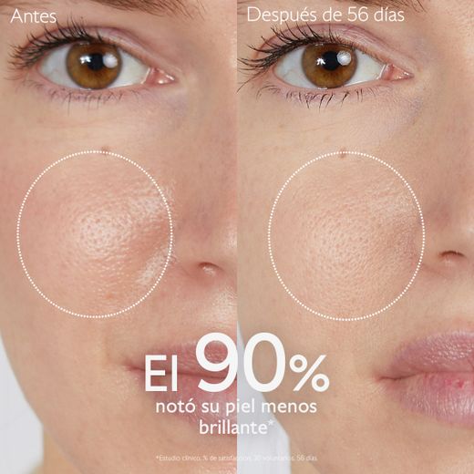 Caudalie Rotina Anti-Imperfeições Pack 4 Produtos