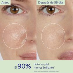 Caudalie Rotina Anti-Imperfeições Pack 4 Produtos