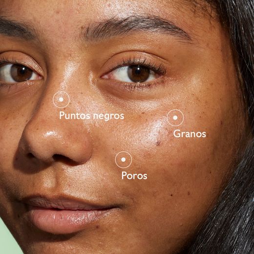 Caudalie Rotina Anti-Imperfeições Pack 4 Produtos