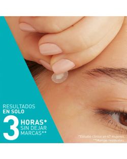 Cerave Anti-Acne Patches 22 Units