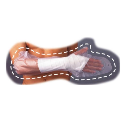 Donjoy Arm Cast Cover