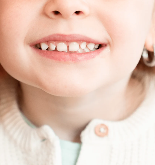 Endro Gel Dental Infantil com Flúor de Morango 175 g
