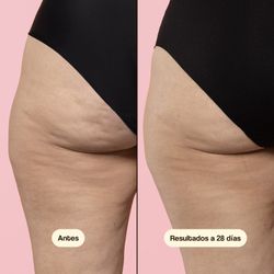 Freshly Beta-Burner Sculpting Treatment 100 ml