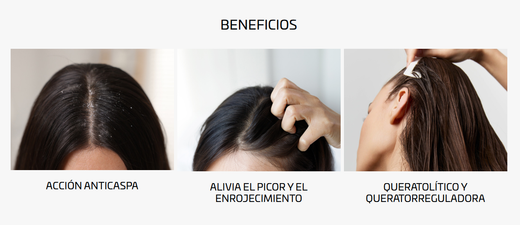 Cantabria Labs Iraltone DS Shampoo Anticaspa 200 ml