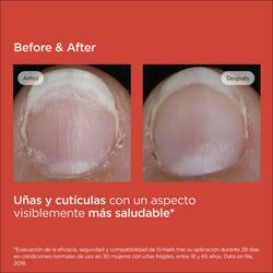 ISDIN SI-NAILS Fortalecedor de uñas e hidratante de cutículas 2,5 ml