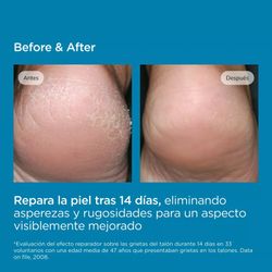 Isdin Ureadin Podos Moisturizing Gel Oil 10% 75 ml