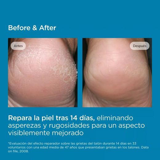 Isdin Ureadin Podos Moisturizing Gel Oil 10% 75 ml