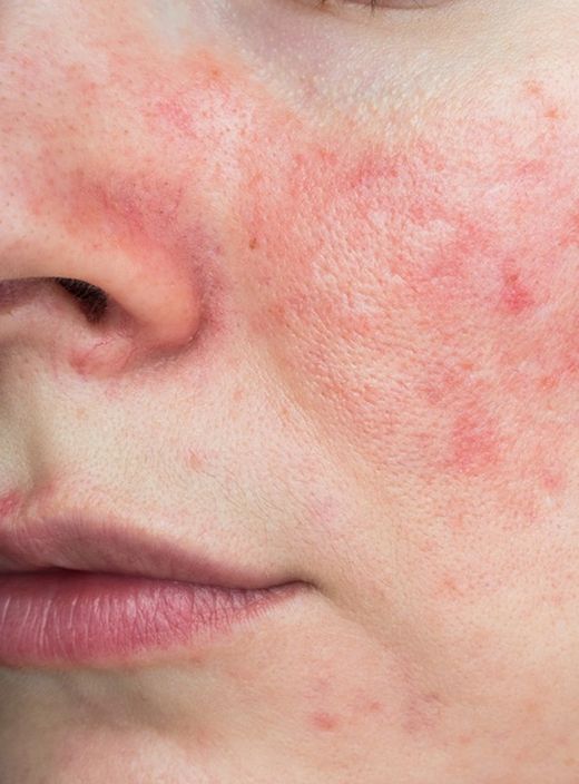 Isispharma Ruboril Cleansing Balm Balsamo Limpiador 100 ml