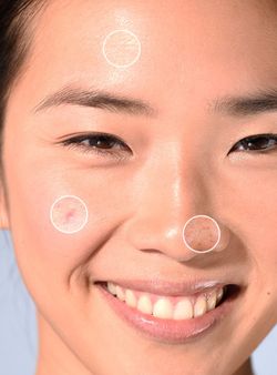 Isispharma Teen Derm Gel Nettoyant Exfoliant 150 ml