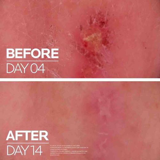 La Roche Posay CICAPLAST Baume B5+