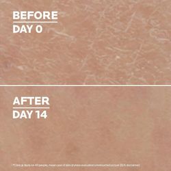 La Roche Posay Lipikar Lait Ureia 10% 400 ml