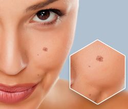 Sérum anti-manchas No-Spot Clair 2 ml