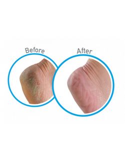 Creme para Pés Saudáveis ​​O'Keeffe's 91 g