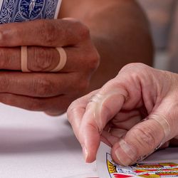 Oval-8 Oval Finger Splint