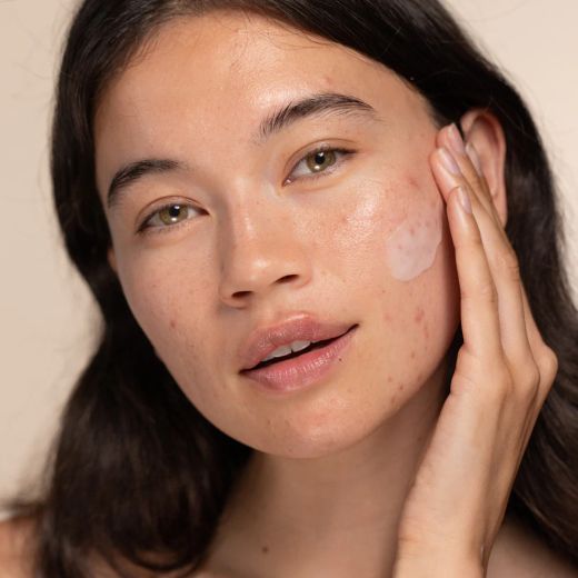 Two Poles Blemishes & Acne Marks Duo Blemish Treatment + Brightening Serum