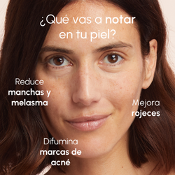 Two Poles Blemishes & Acne Marks Duo Blemish Treatment + Brightening Serum